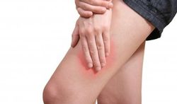 Meralgia paraesthetica: een geknelde zenuw in het bovenbeen
