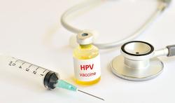 Is vaccinatie tegen HPV ook nuttig als u al seks hebt gehad?
