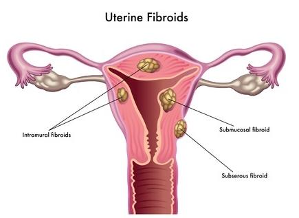 tongue cancer treatment