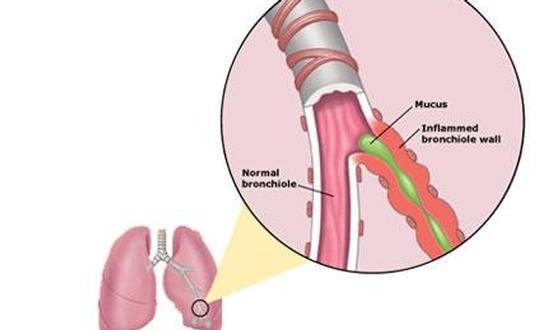 Viral symptoms in adults
