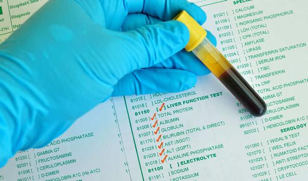 Leverfunctieonderzoek: wat betekenen afwijkende levertests? | gezondheid.be