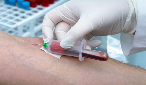 Nieuwe bloedtest helpt reuma te voorkomen | gezondheid.be