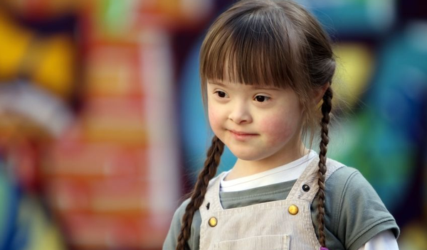 Supplementen beïnvloeden gezichtsvorming bij kinderen met Downsyndroom