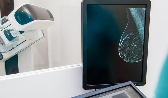 Новый скрининг молочных желез ПАМмография безболезненна и более точна, чем маммография.