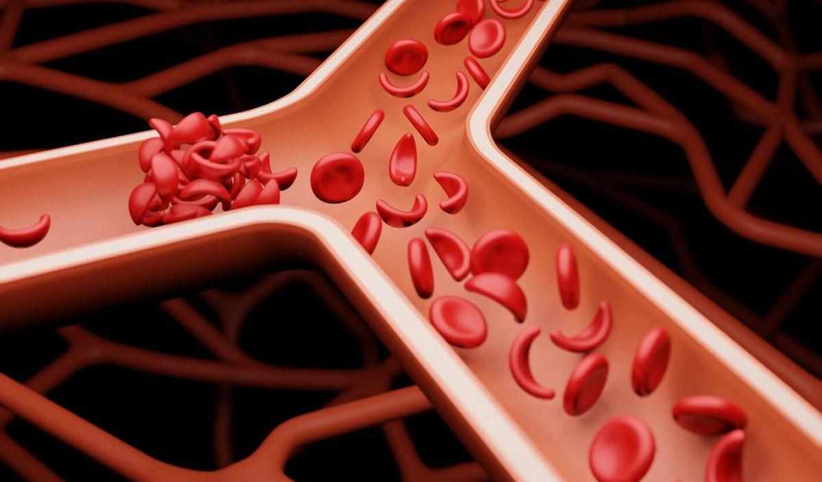 Bloedverdunners en voeding | gezondheid.be