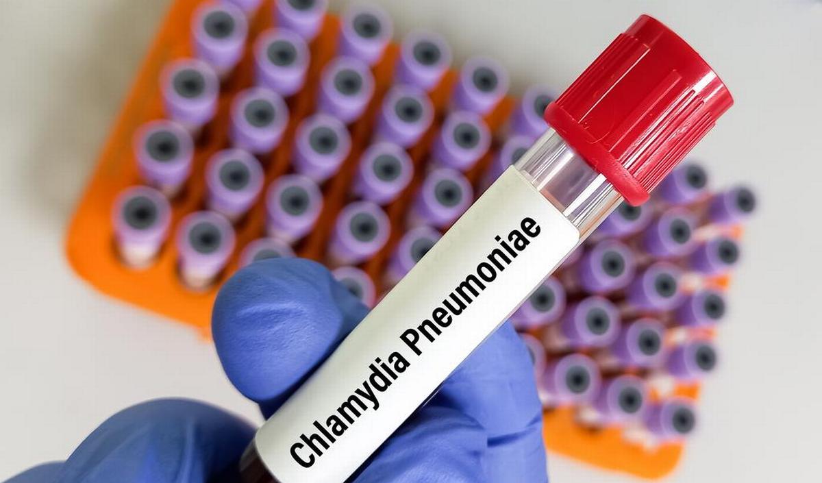 Chlamydia pneumoniae: causa infezioni respiratorie e malattie croniche