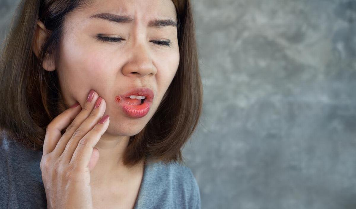 Wat kan je doen aan een scheurmond of mondhoekkloofjes? | gezondheid.be