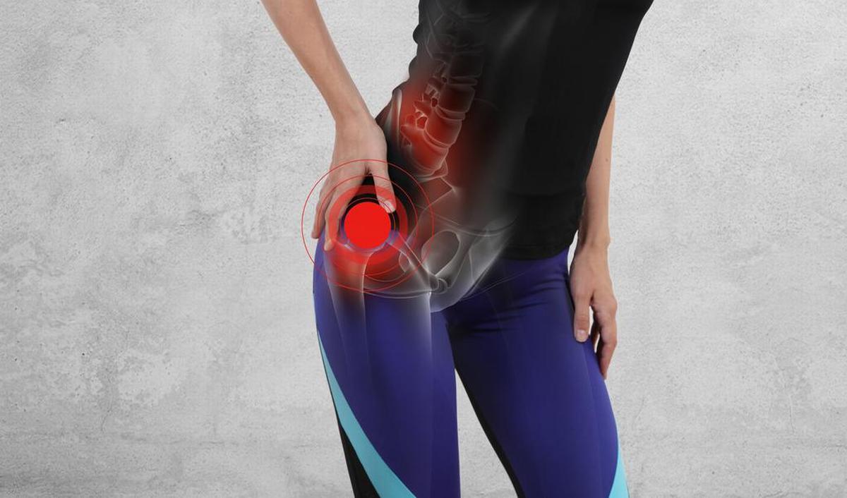 Grote trochanter pijnsyndroom (trochanter major) | gezondheid.be