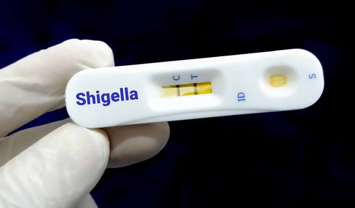 Shigellosi: diarrea sanguinolenta altamente contagiosa e resistente agli antibiotici