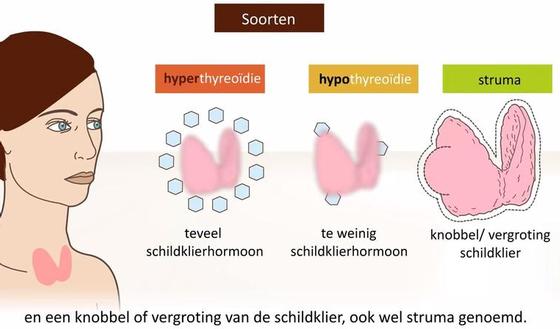 Video: Schildklierproblemen | gezondheid.be